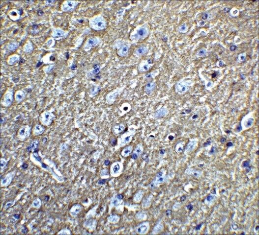 Anti-LMX1B antibody produced in rabbit