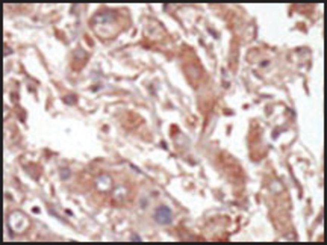 Anti-LOK (C-term E707) antibody produced in rabbit