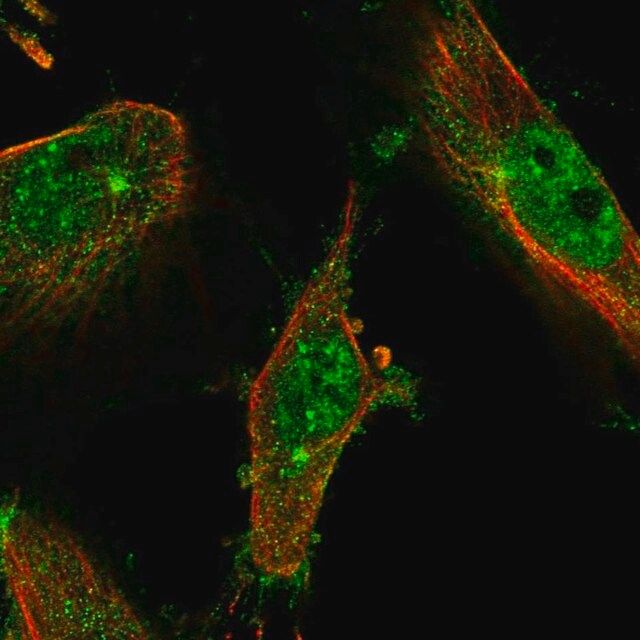 Anti-LMTK2 antibody produced in rabbit