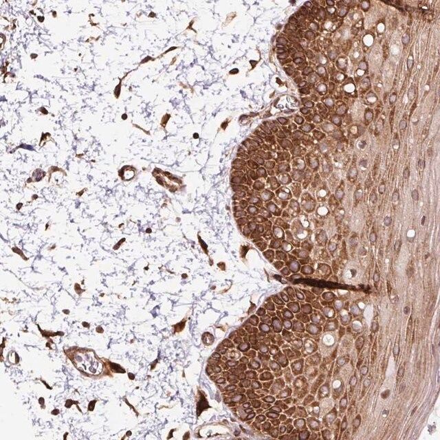 Anti-KDM4E antibody produced in rabbit