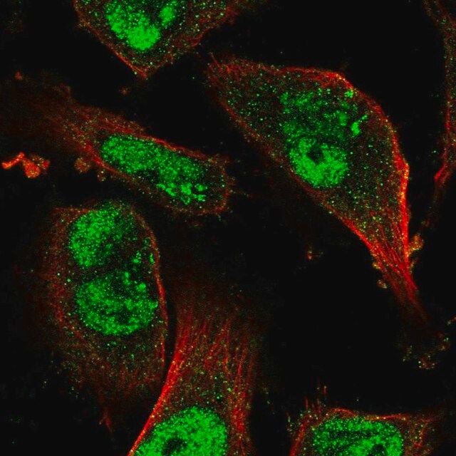 Anti-KDM3B antibody produced in rabbit