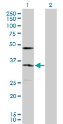 Anti-KDELR2 antibody produced in rabbit