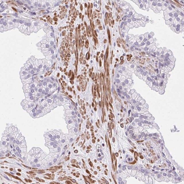 Anti-KCNN4 antibody produced in rabbit