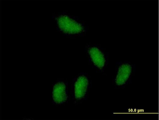 Anti-KCTD15 antibody produced in mouse