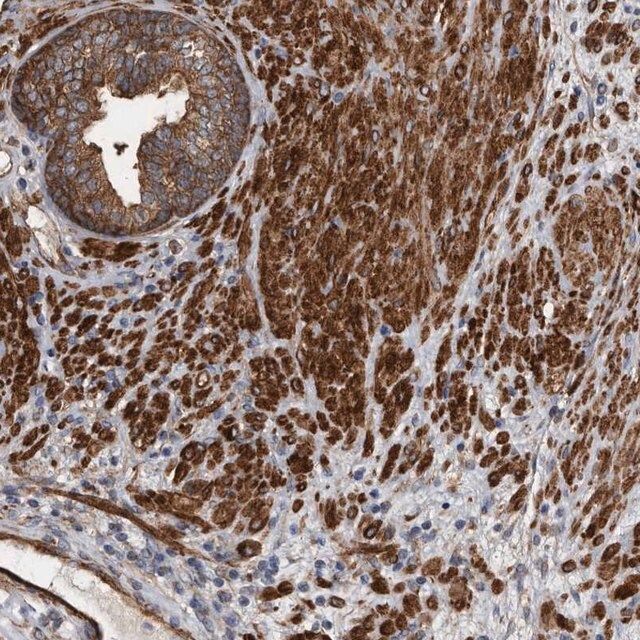 Anti-KCTD20 antibody produced in rabbit