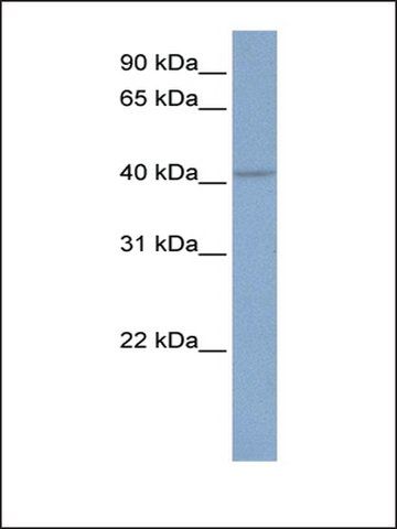 Anti-KCNN4 antibody produced in rabbit