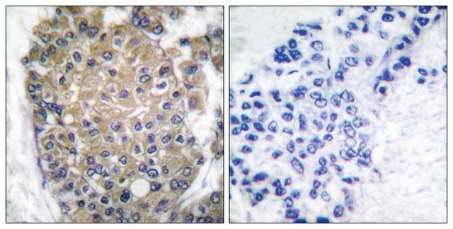 Anti-Keratin 17 antibody produced in rabbit