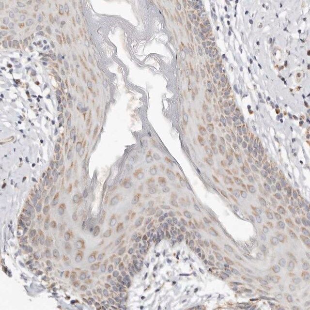 Anti-KDF1 antibody produced in rabbit