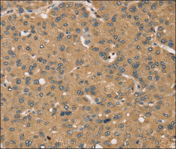 Anti-KDM5A antibody produced in rabbit