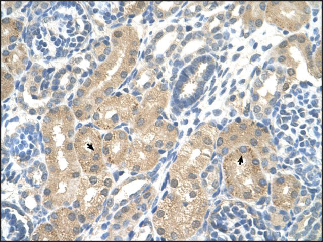 Anti-KHK antibody produced in rabbit