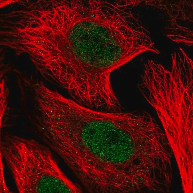 Anti-KDELC1 antibody produced in rabbit