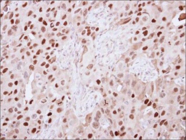 ANTI-KDM6A antibody produced in rabbit