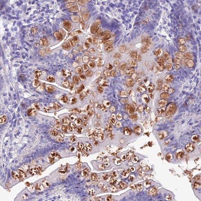 Anti-KDELR3 antibody produced in rabbit
