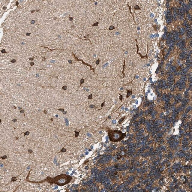 Anti-KDELR2 antibody produced in rabbit