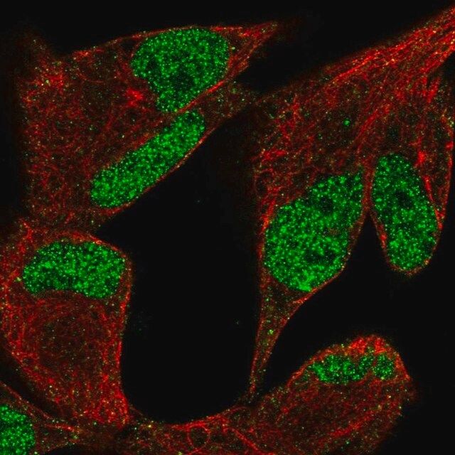 Anti-KDM3A antibody produced in rabbit
