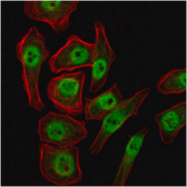 Anti-KDM4A Antibody, clone5H1