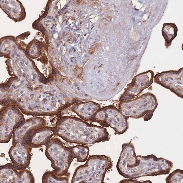 Anti-KDSR antibody produced in rabbit