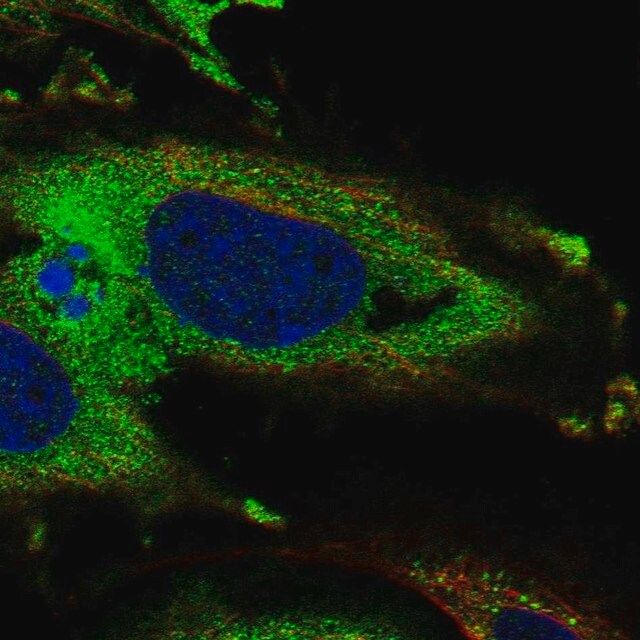 Anti-KDELR3 antibody produced in rabbit