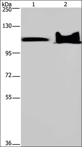 Anti-KDM4C antibody produced in rabbit
