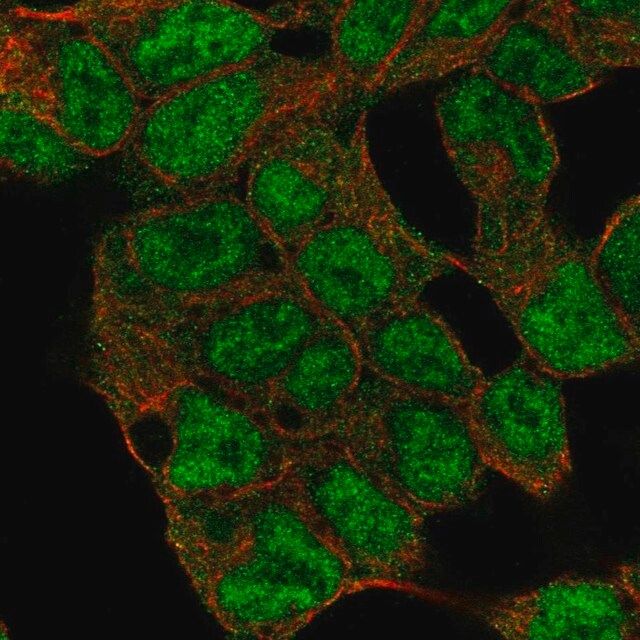 Anti-KDM5C antibody produced in rabbit