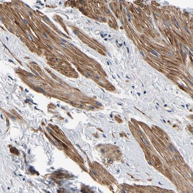 Anti-KCTD17 antibody produced in rabbit