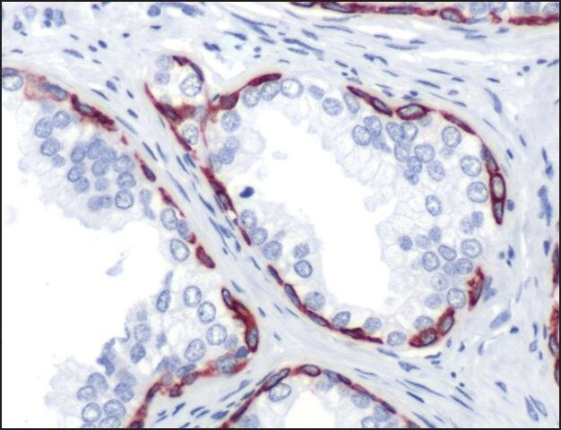Anti-Keratin 14 antibody, Rabbit monoclonal