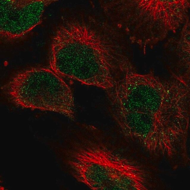 Anti-KDM3A antibody produced in rabbit