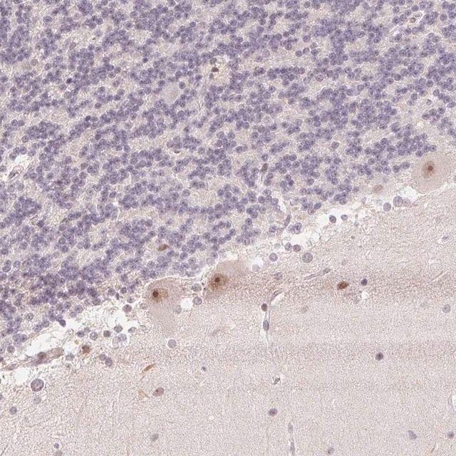 Anti-KDM4D antibody produced in rabbit