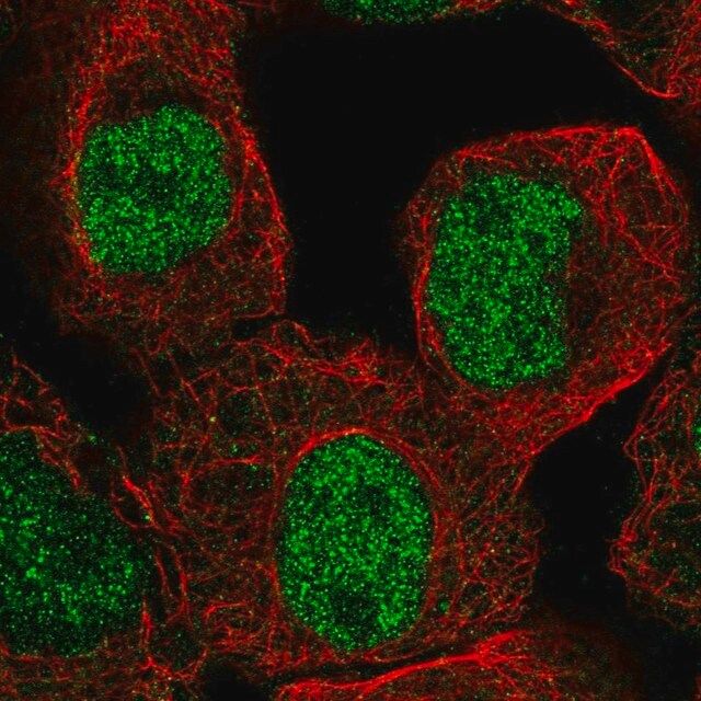 Anti-KDM4C antibody produced in rabbit