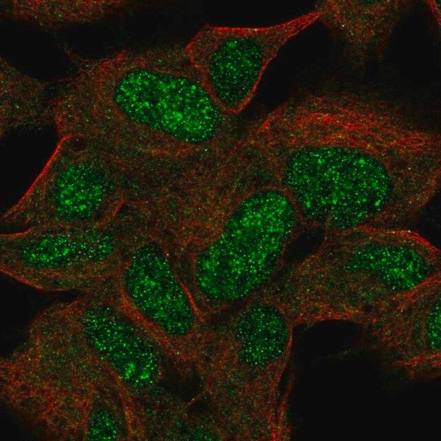 Anti-KIAA0408 antibody produced in rabbit
