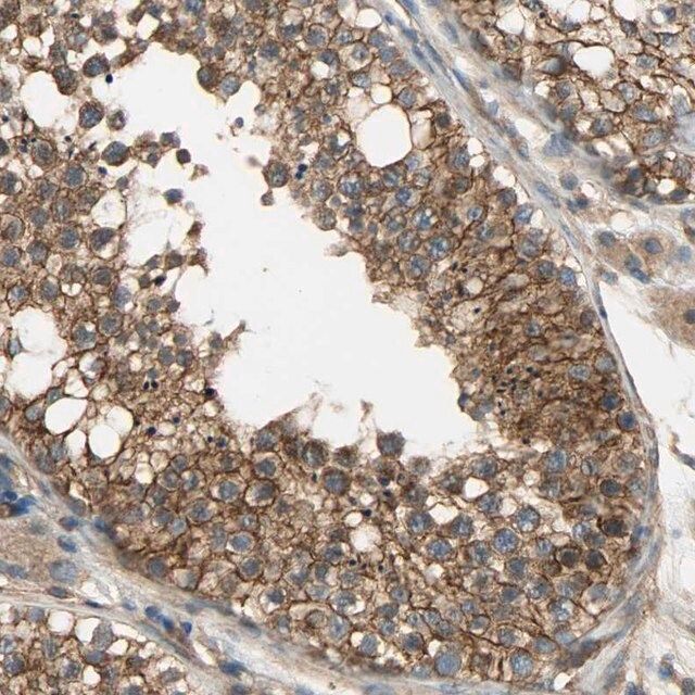Anti-KIAA1217 antibody produced in rabbit