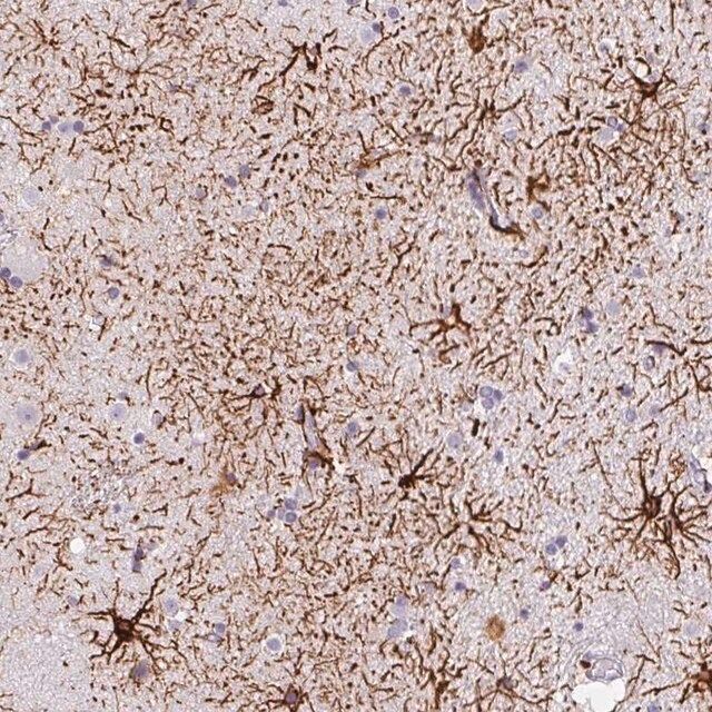 Anti-KIAA0368 antibody produced in rabbit
