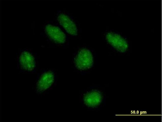 Anti-KIAA1456, (N-terminal) antibody produced in mouse