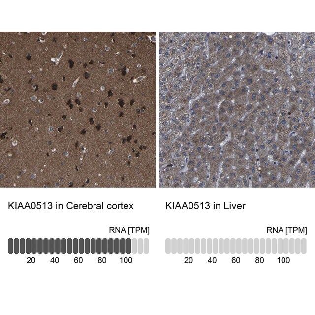 Anti-KIAA0513 antibody produced in rabbit