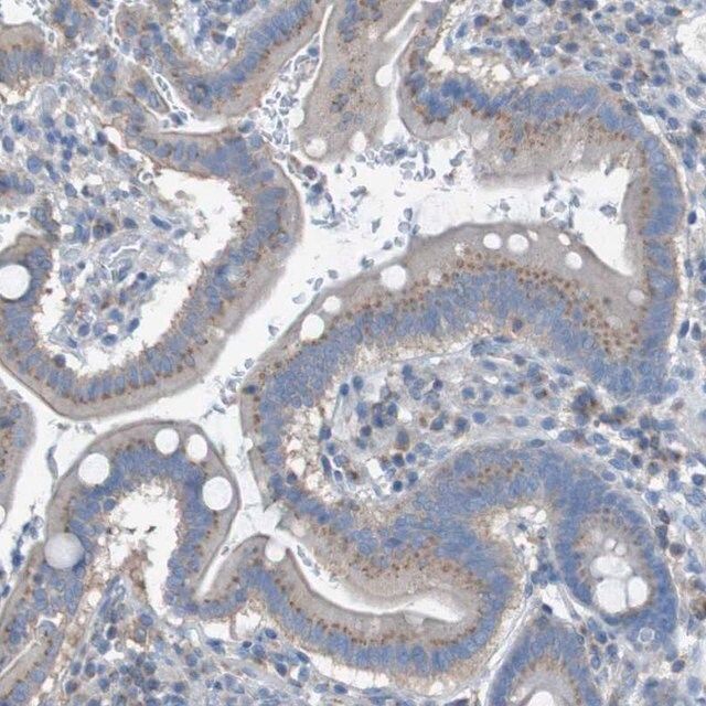 Anti-KIAA1024 antibody produced in rabbit