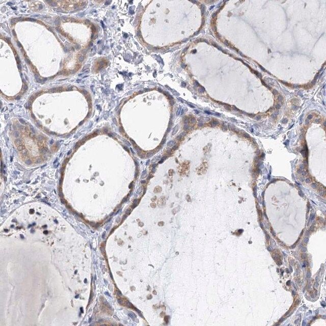 Anti-KIAA1109 antibody produced in rabbit