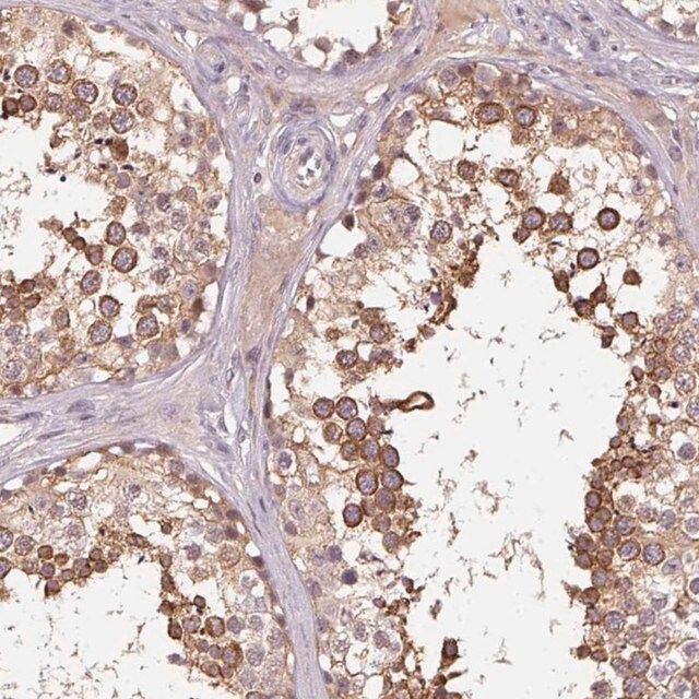 Anti-KIAA1257 antibody produced in rabbit