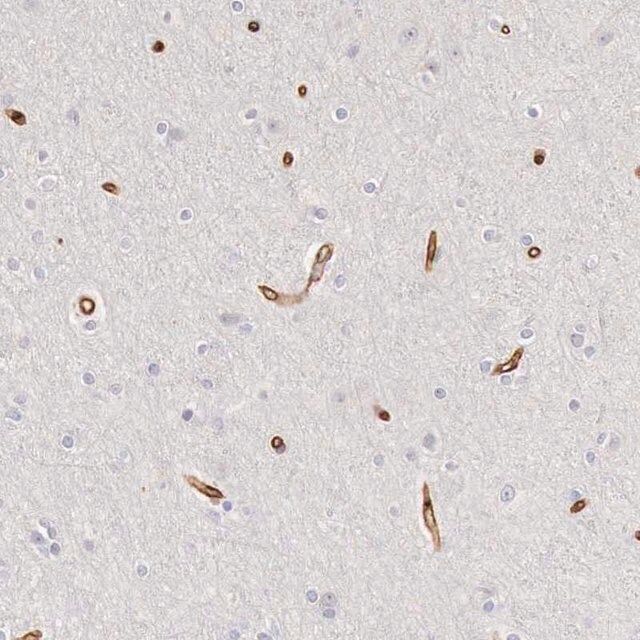 Anti-KIAA2022 antibody produced in rabbit
