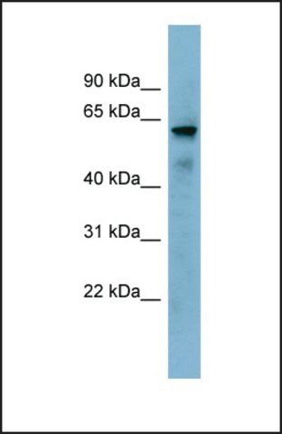 Anti-KIAA1627, (N-terminal) antibody produced in rabbit