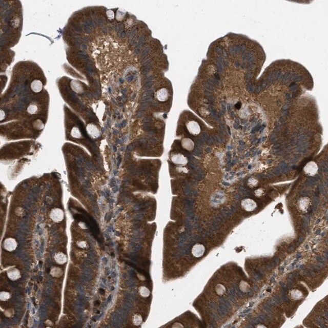 Anti-KIAA0430 antibody produced in rabbit