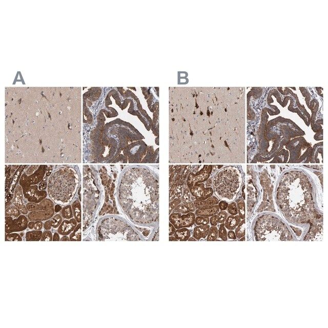 Anti-KIAA0753 antibody produced in rabbit