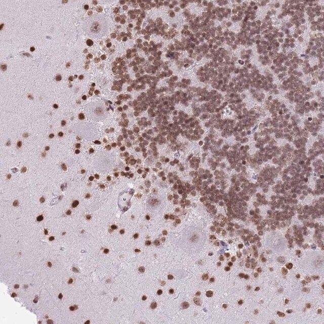 Anti-KIAA1644 antibody produced in rabbit