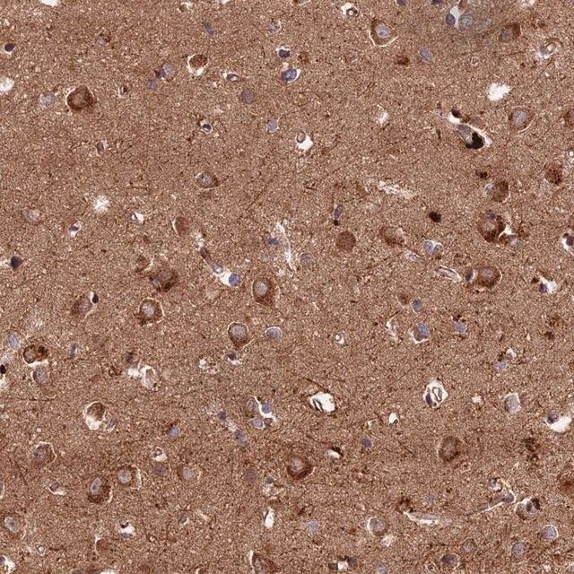 Anti-KIAA1468 antibody produced in rabbit