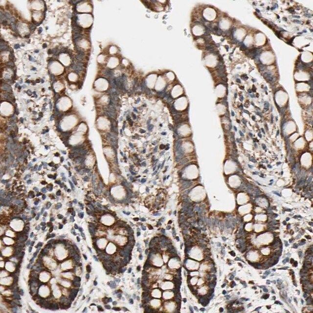 Anti-KIAA0907 antibody produced in rabbit