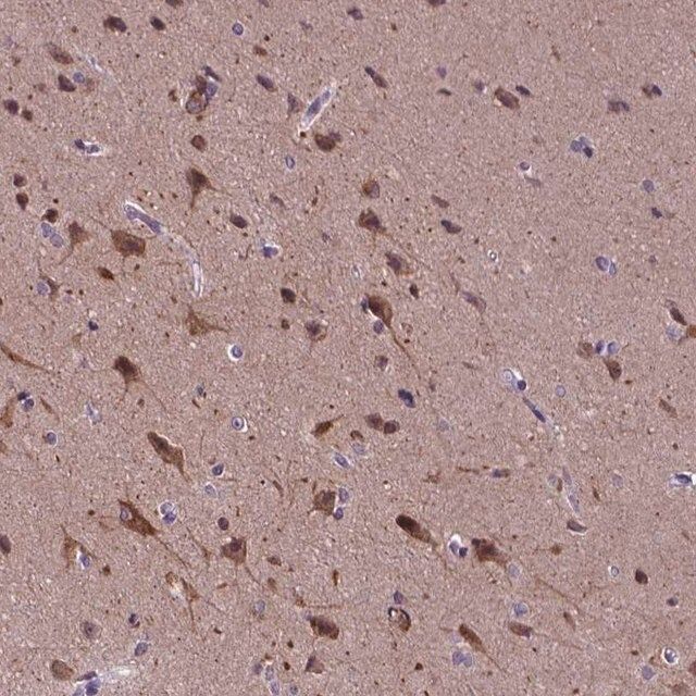 Anti-KIAA1107 antibody produced in rabbit