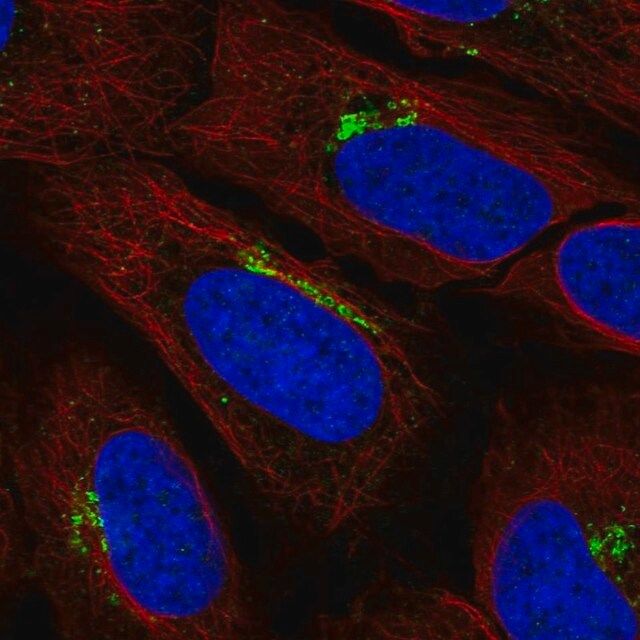 Anti-KIAA0319L antibody produced in rabbit