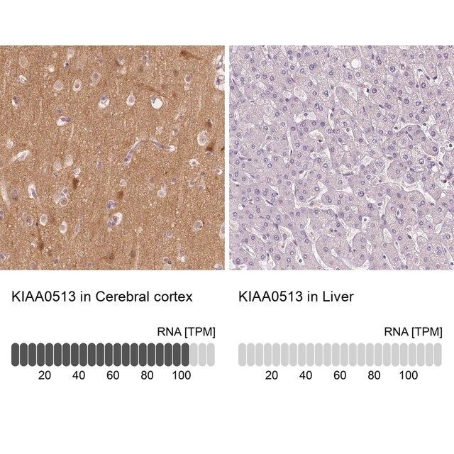 Anti-KIAA0513 antibody produced in rabbit