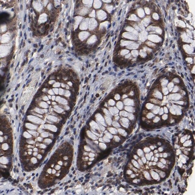 Anti-KIAA2026 antibody produced in rabbit