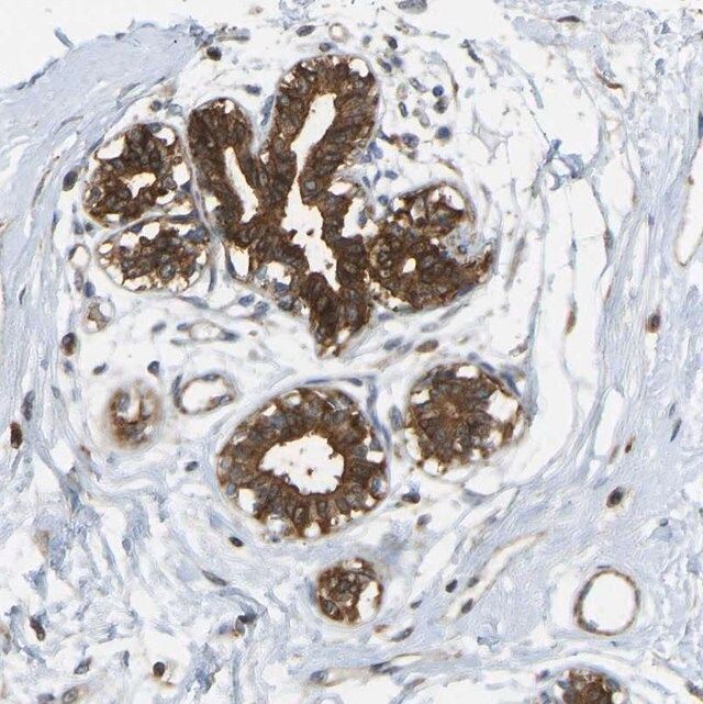 Anti-KIAA1671 antibody produced in rabbit