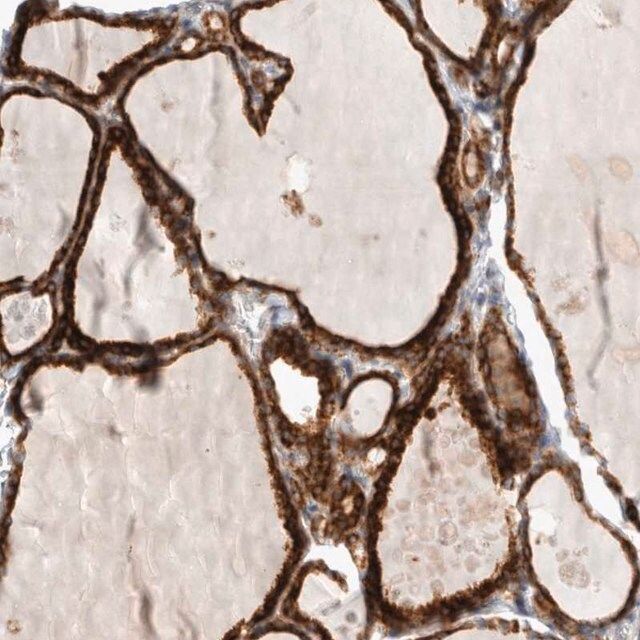 Anti-KIAA1456 antibody produced in rabbit